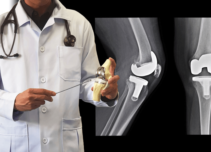 Orthopaedic surgeon in Delhi