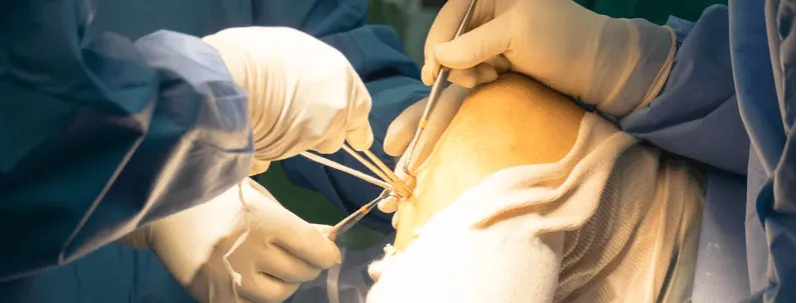 Orthopaedic surgeon in Delhi