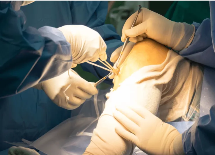 Orthopaedic surgeon in Delhi